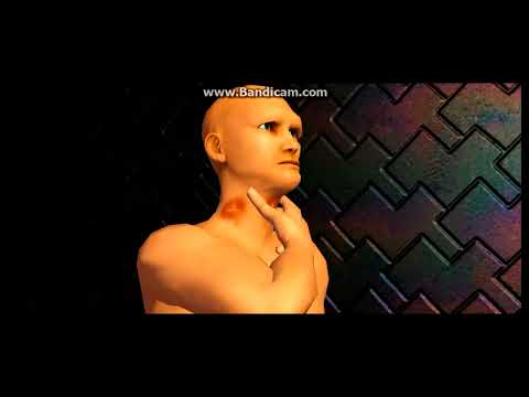 MM4: EXOTIC MADNESS (TRAILER)