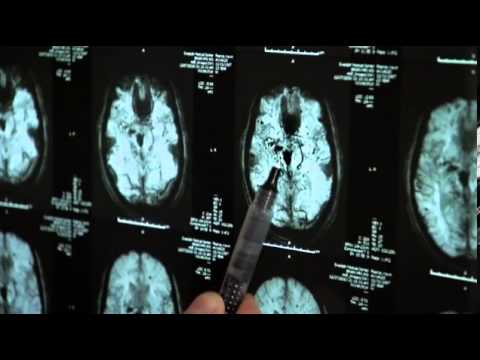 The Crash Reel trailer