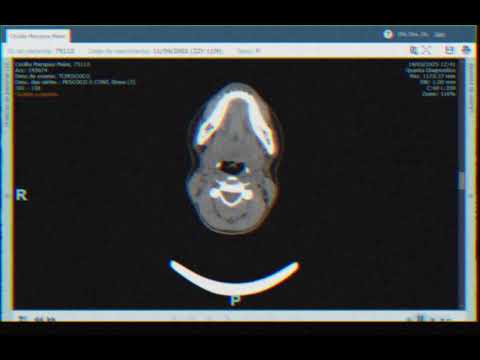 Uma tomografia do meu pescoço (2025)