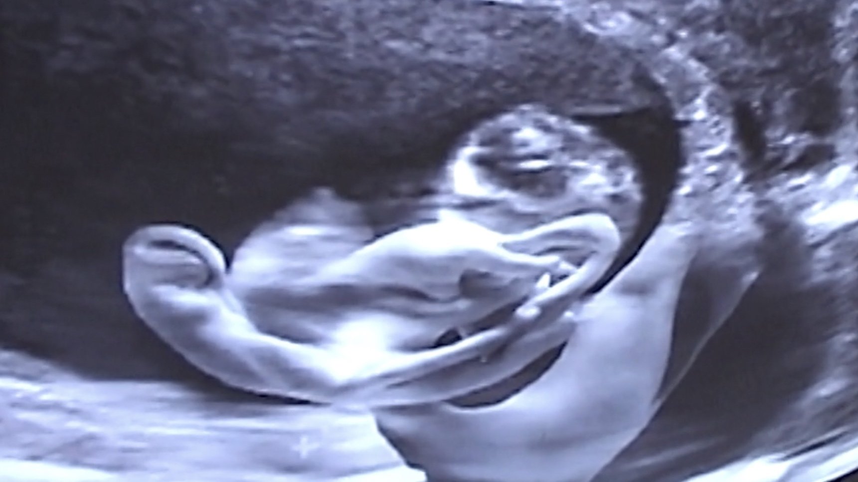 Backdrop for Castration Movie Anthology iii. Year of the Hyaena