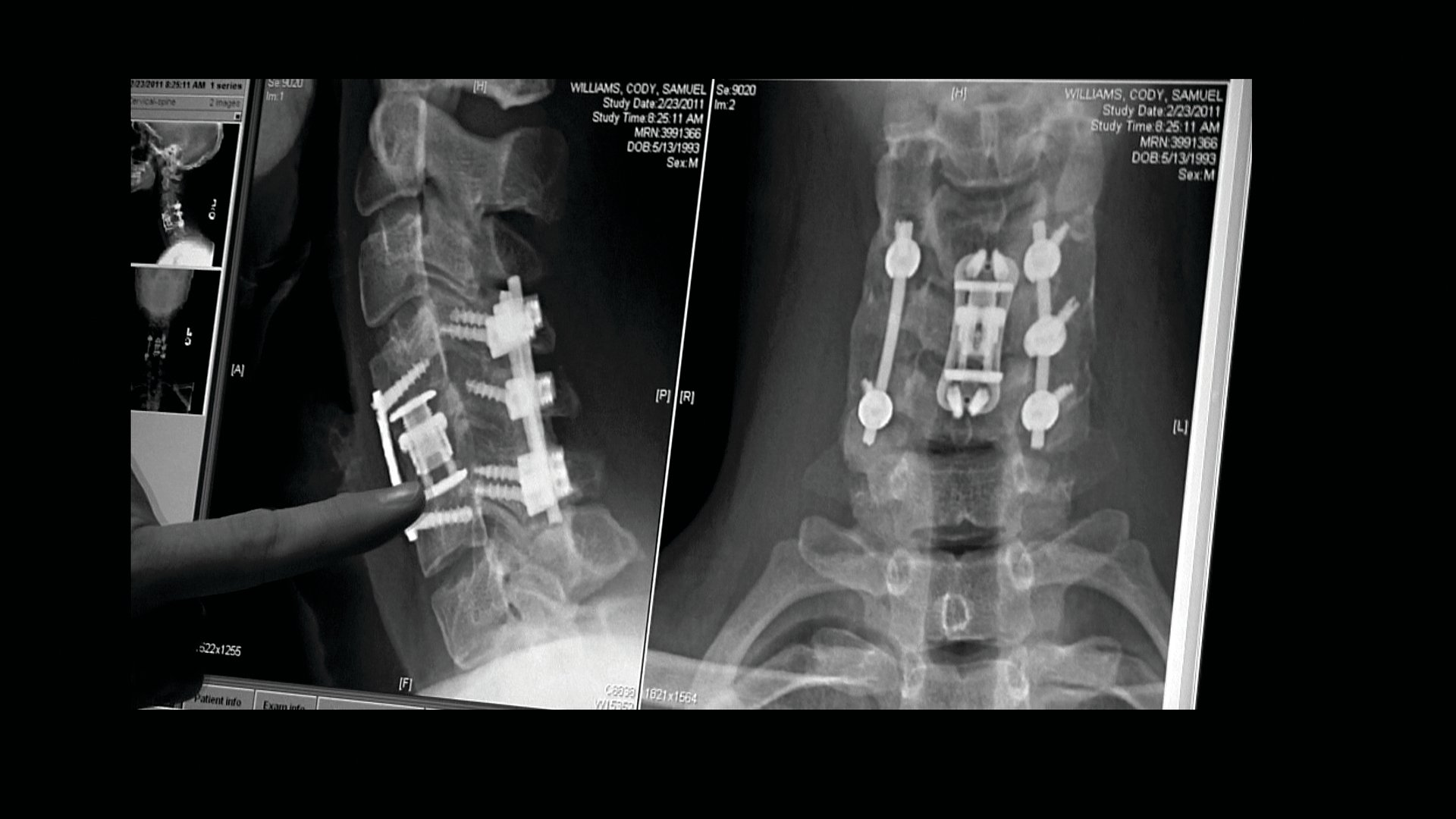 Backdrop for The Hill Chris Climbed: The Gridiron Heroes Story