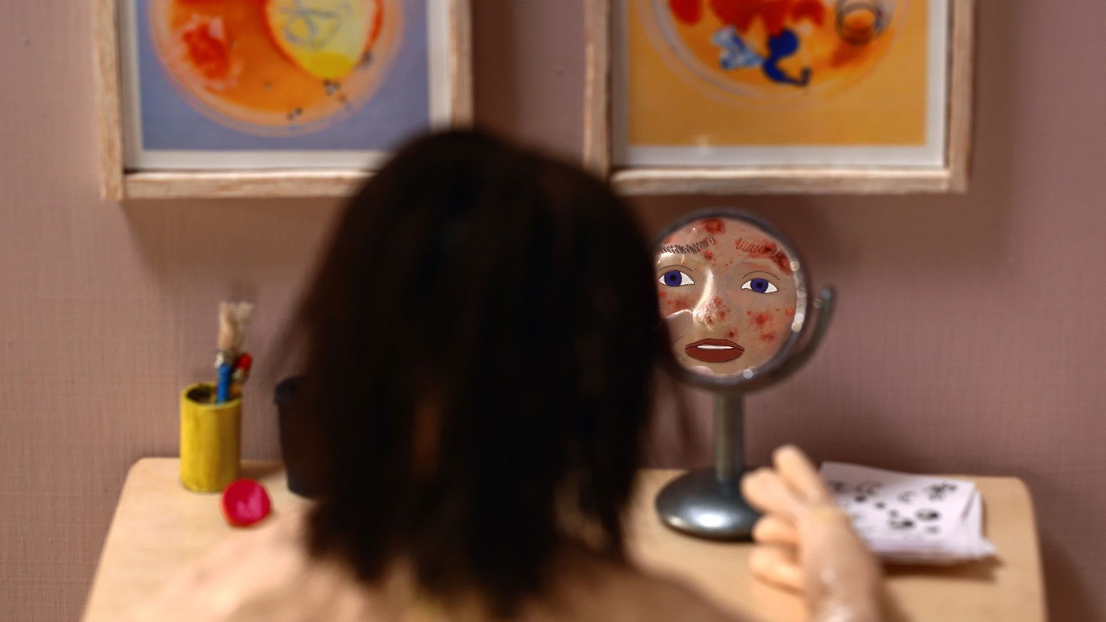 Backdrop for Blackheads