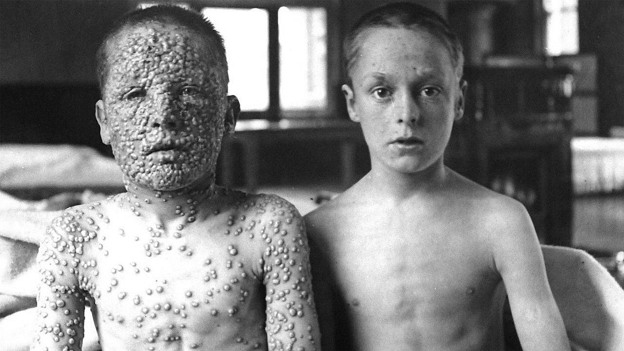 Backdrop for Outbreak: Anatomy of a Plague