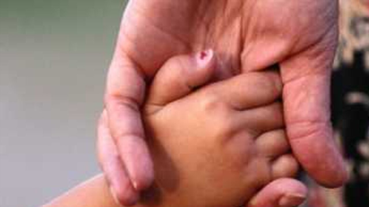 Backdrop for I Have Tourette's But Tourette's Doesn't Have Me