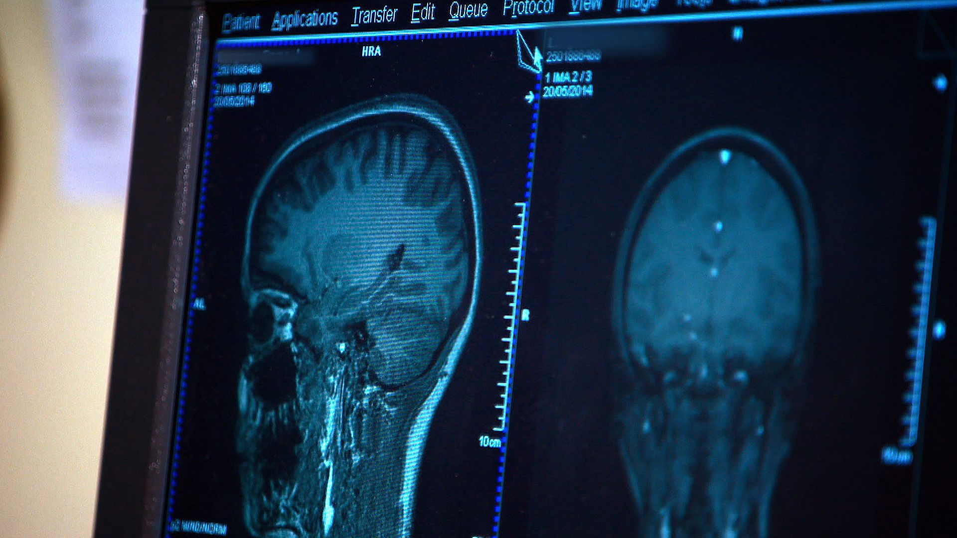 Backdrop for Mind Games