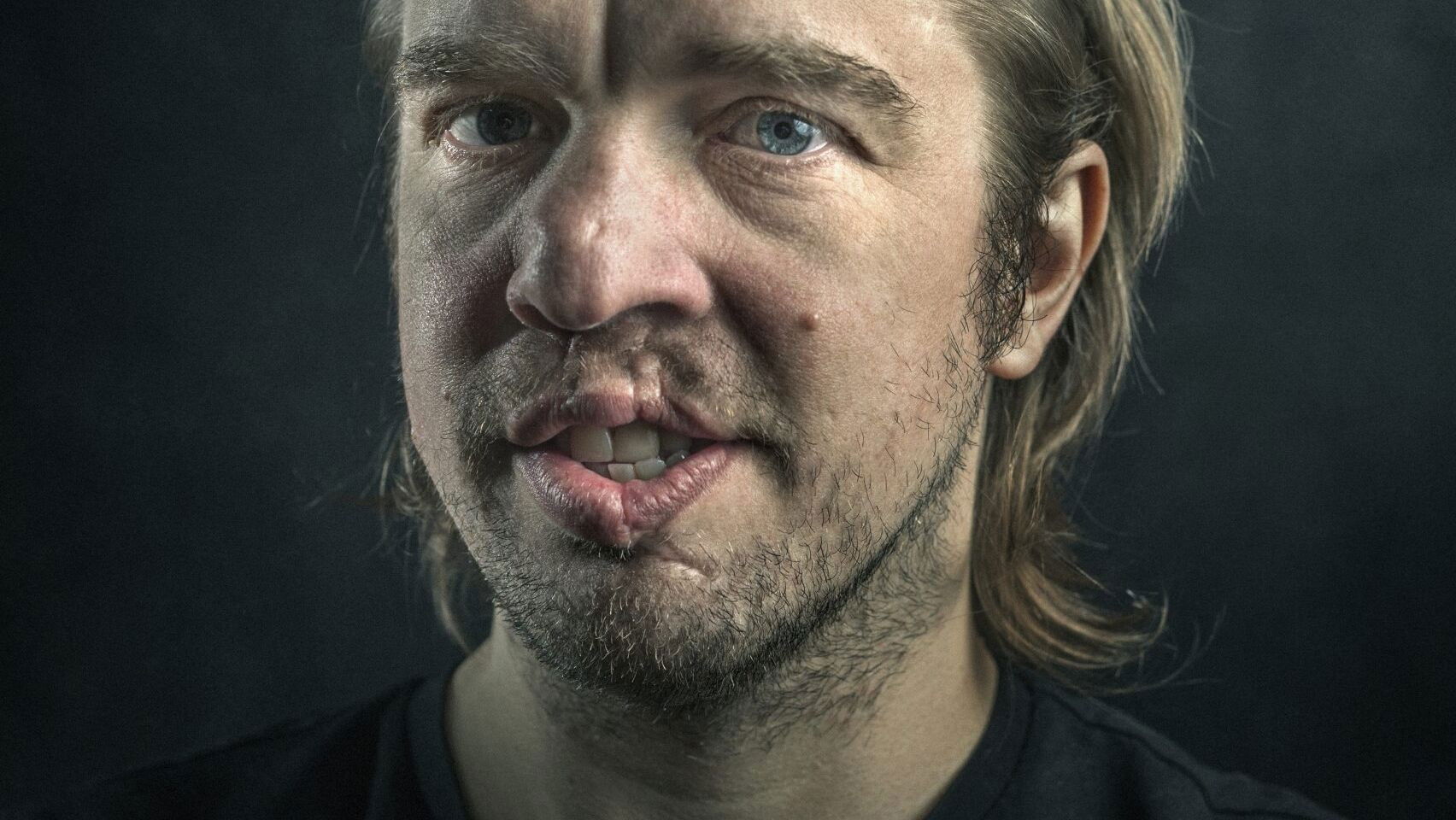 Backdrop for Jan Jaap van der Wal: Huidhonger