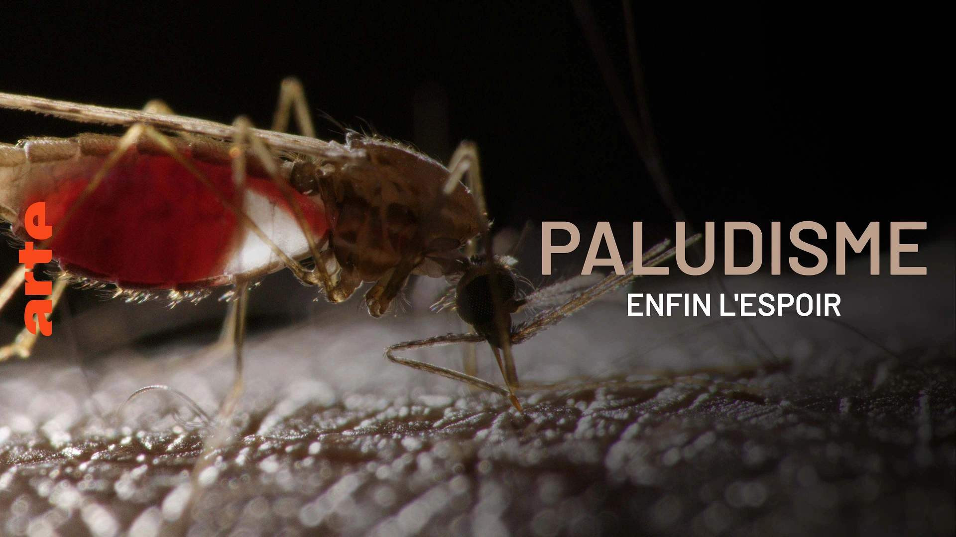 Backdrop for Paludisme, enfin l'espoir