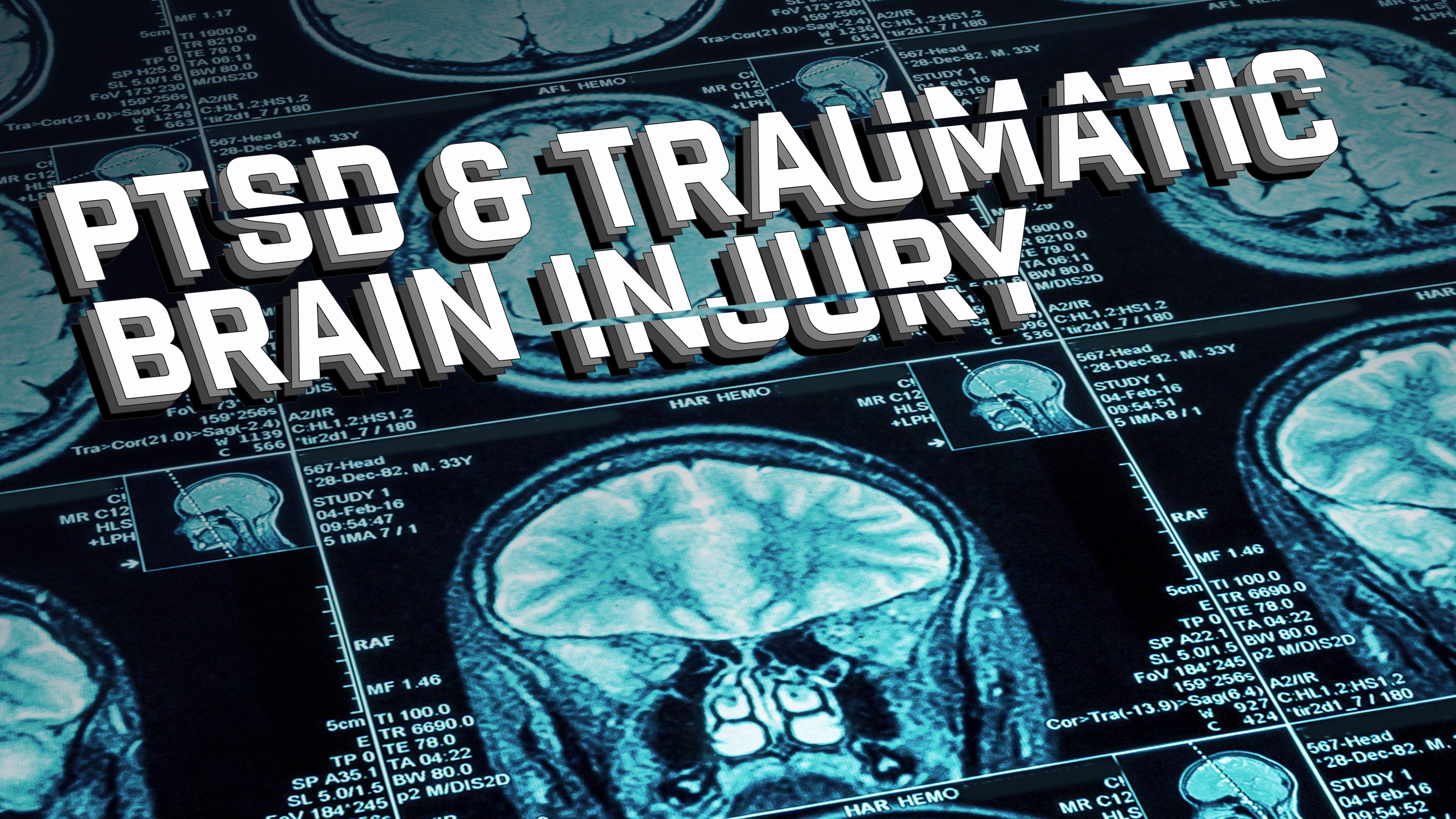 Backdrop for Joel Hunt: Traumatic Brain Injury (TBI)