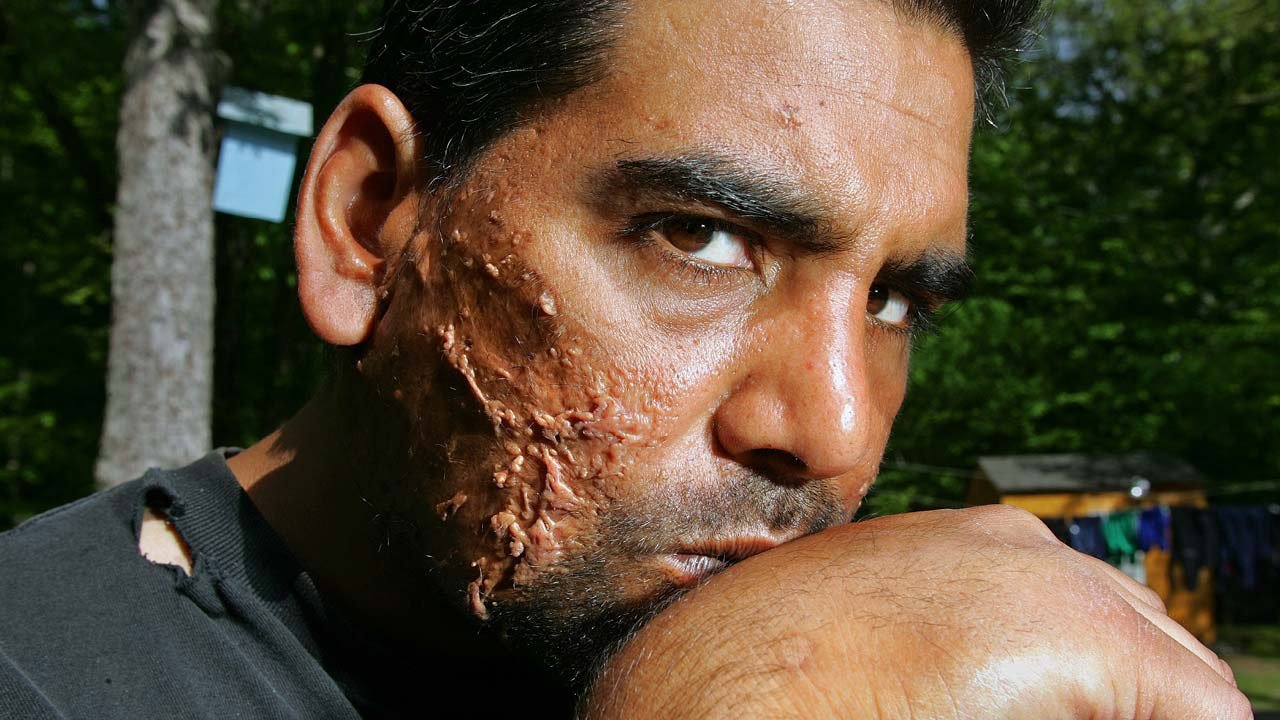 Backdrop for Mann v. Ford