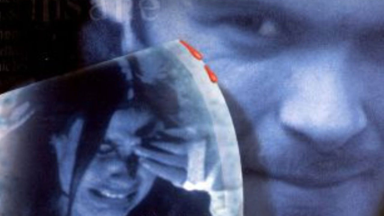 Backdrop for Dementia