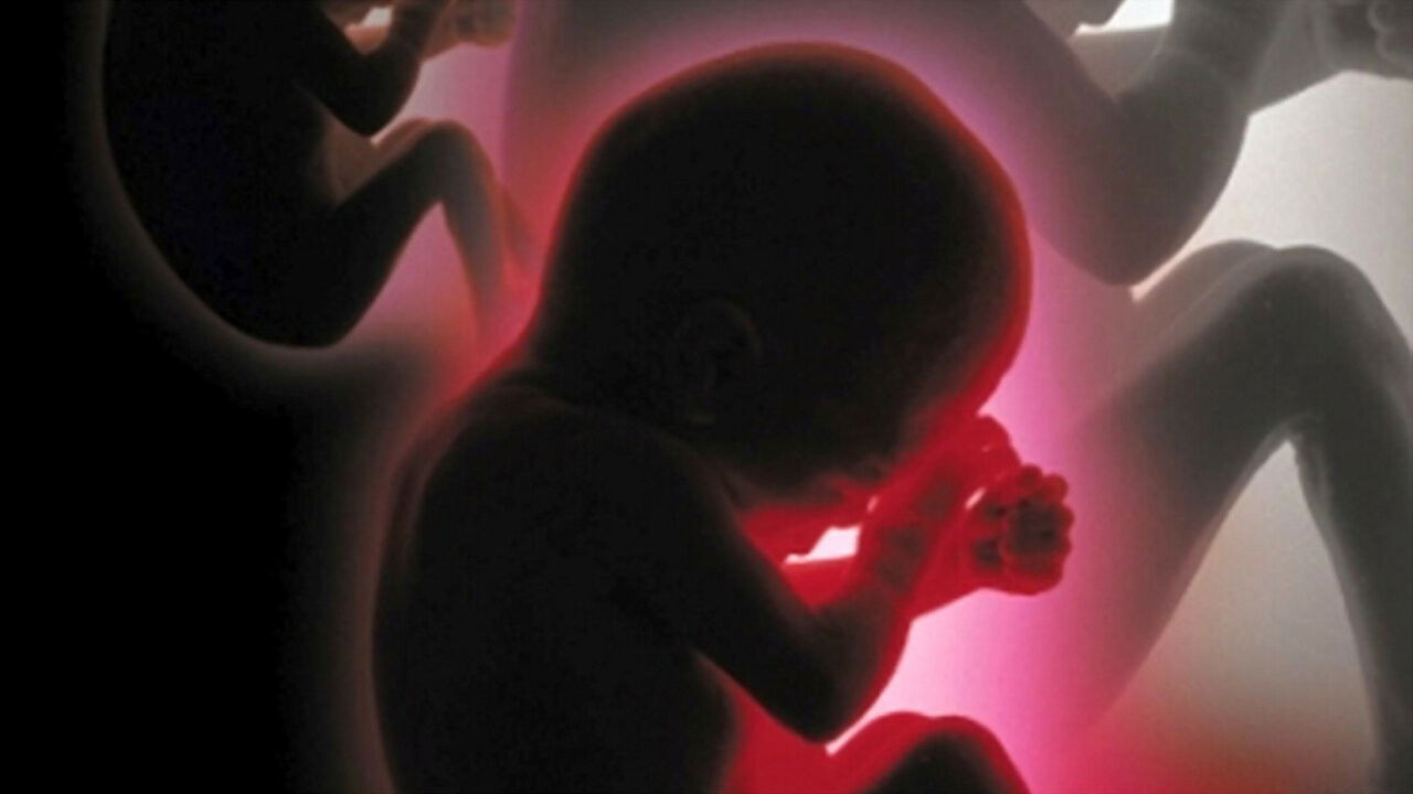 Backdrop for Proyecto Cassandra