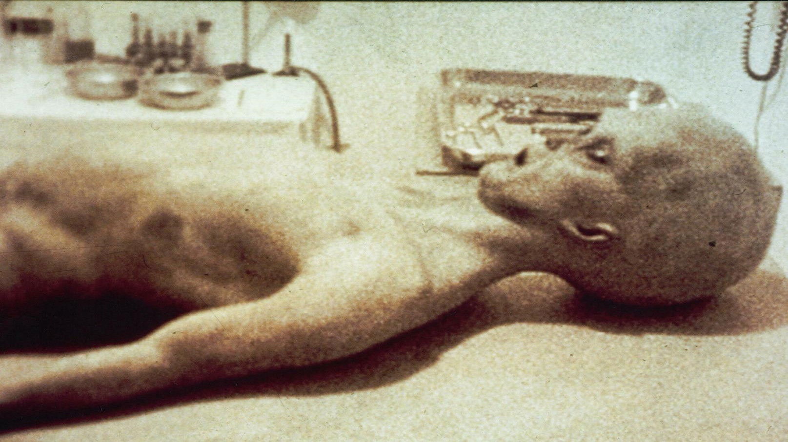 Backdrop for The Alien Autopsy
