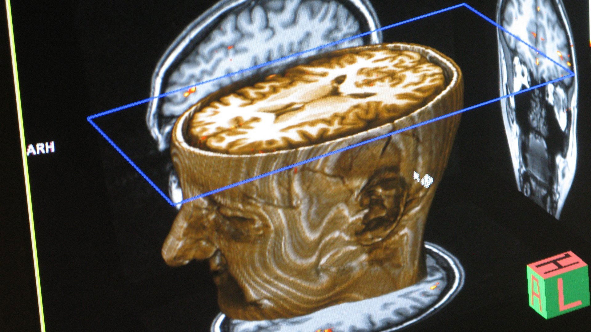 Backdrop for Journey Into Dyslexia