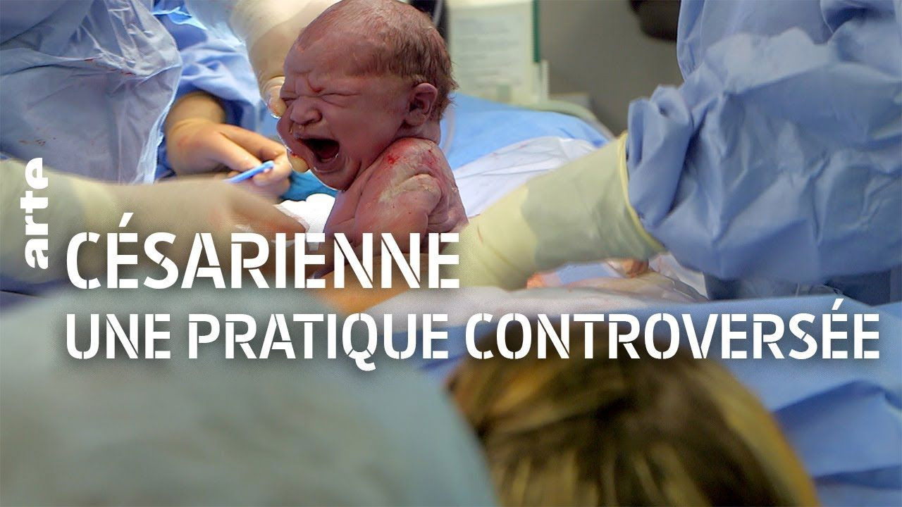 Backdrop for The C-Section Controversy