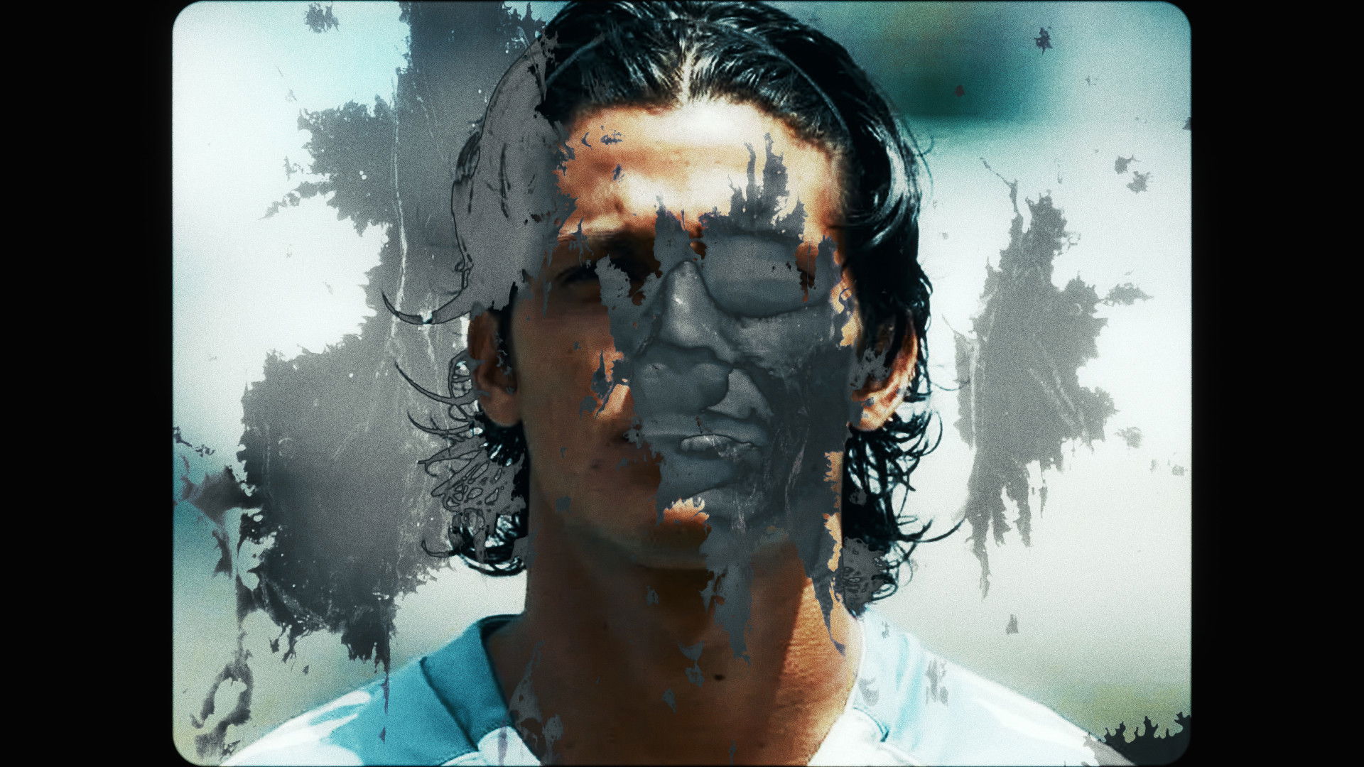 Backdrop for Vitiligo