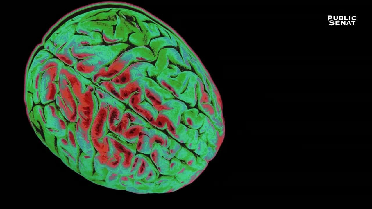 Backdrop for Le pouvoir nuit-il gravement au cerveau ?