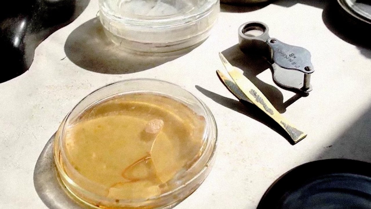 Backdrop for Penicillin: A Medical Revolution