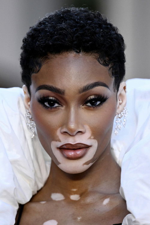 Photo of Winnie Harlow