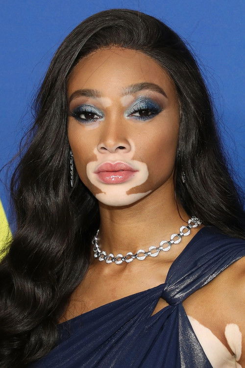 Photo of Winnie Harlow