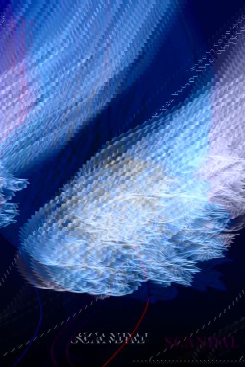 SCANDAL WORLD TOUR 2020 “Kiss from the darkness” Livestream