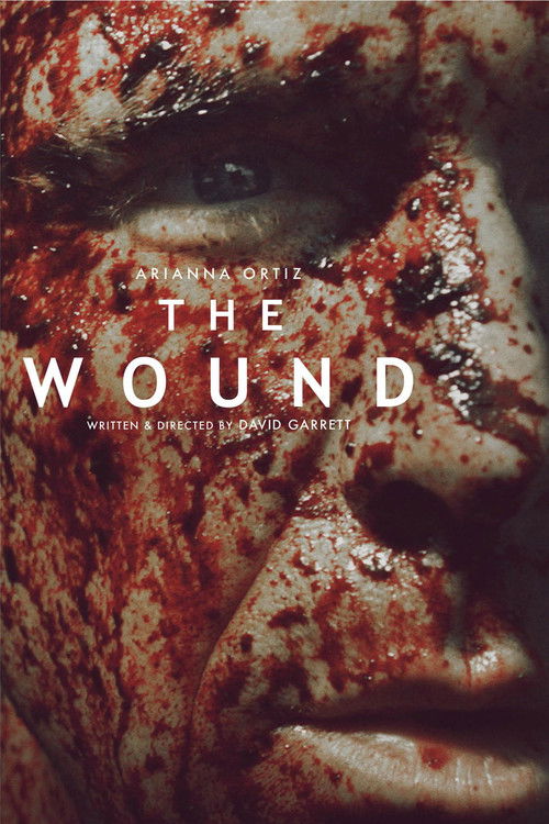 The Wound