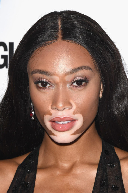 Photo of Winnie Harlow