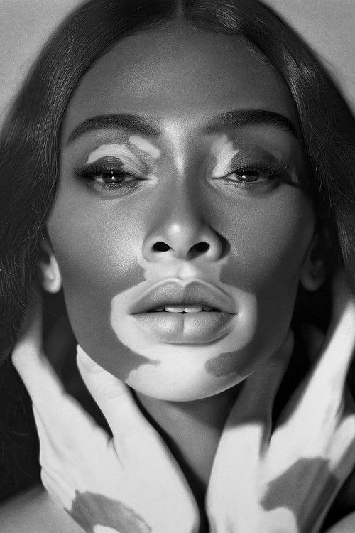 Photo of Winnie Harlow