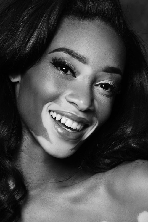 Photo of Winnie Harlow