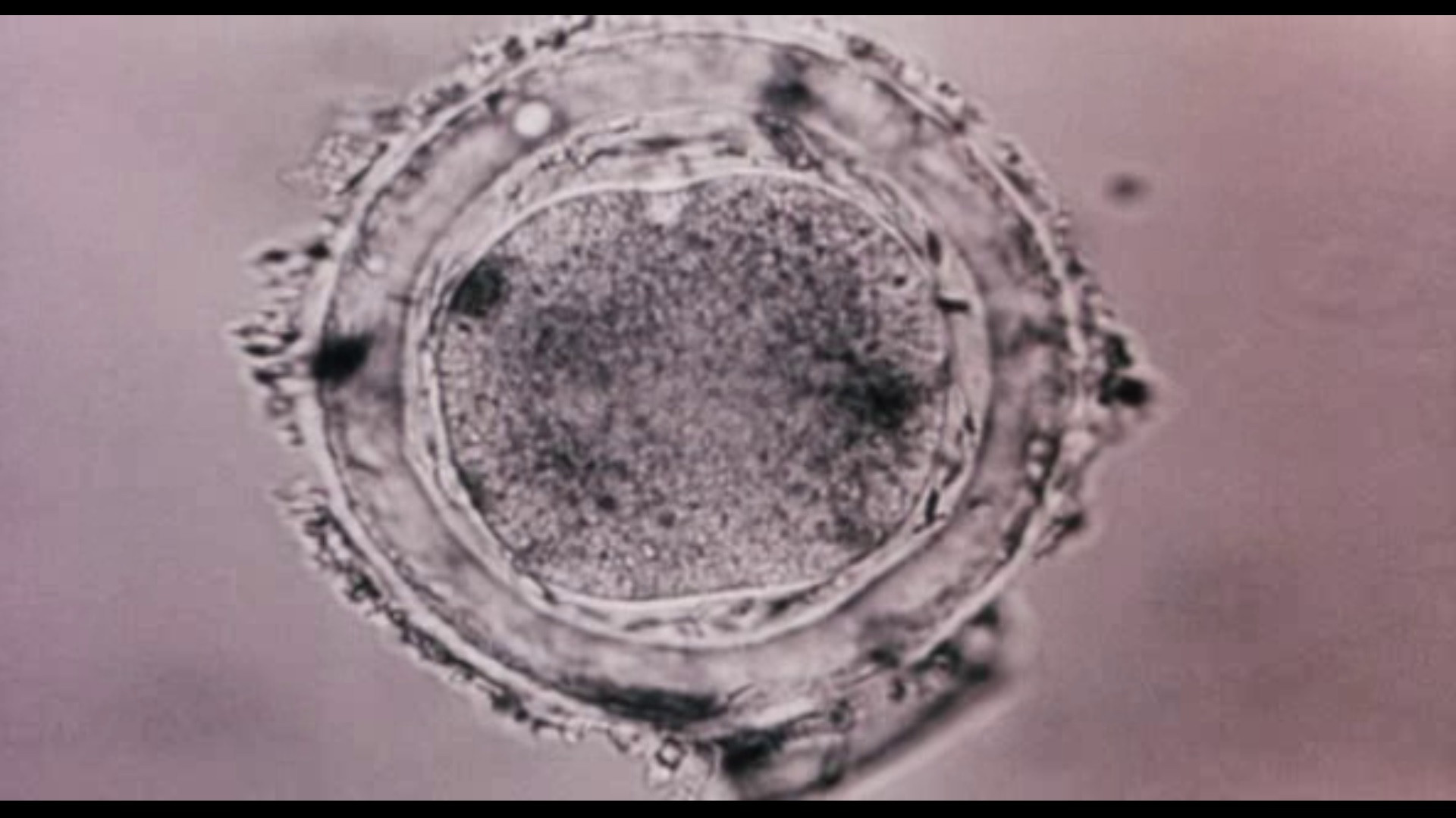 Backdrop for Bodysong