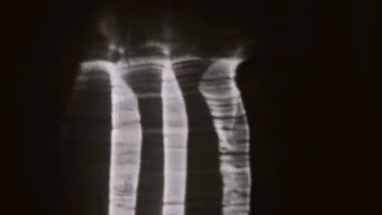 Backdrop for The Achalunés