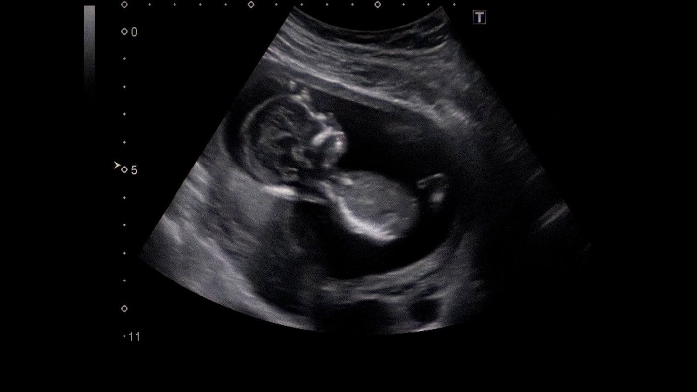 Backdrop for Foreign Bodies