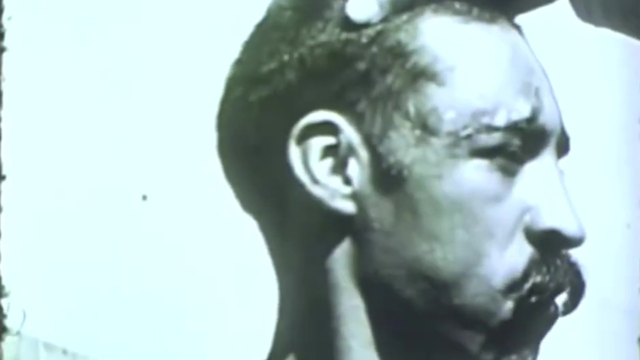 Backdrop for Rabies in a Human Patient