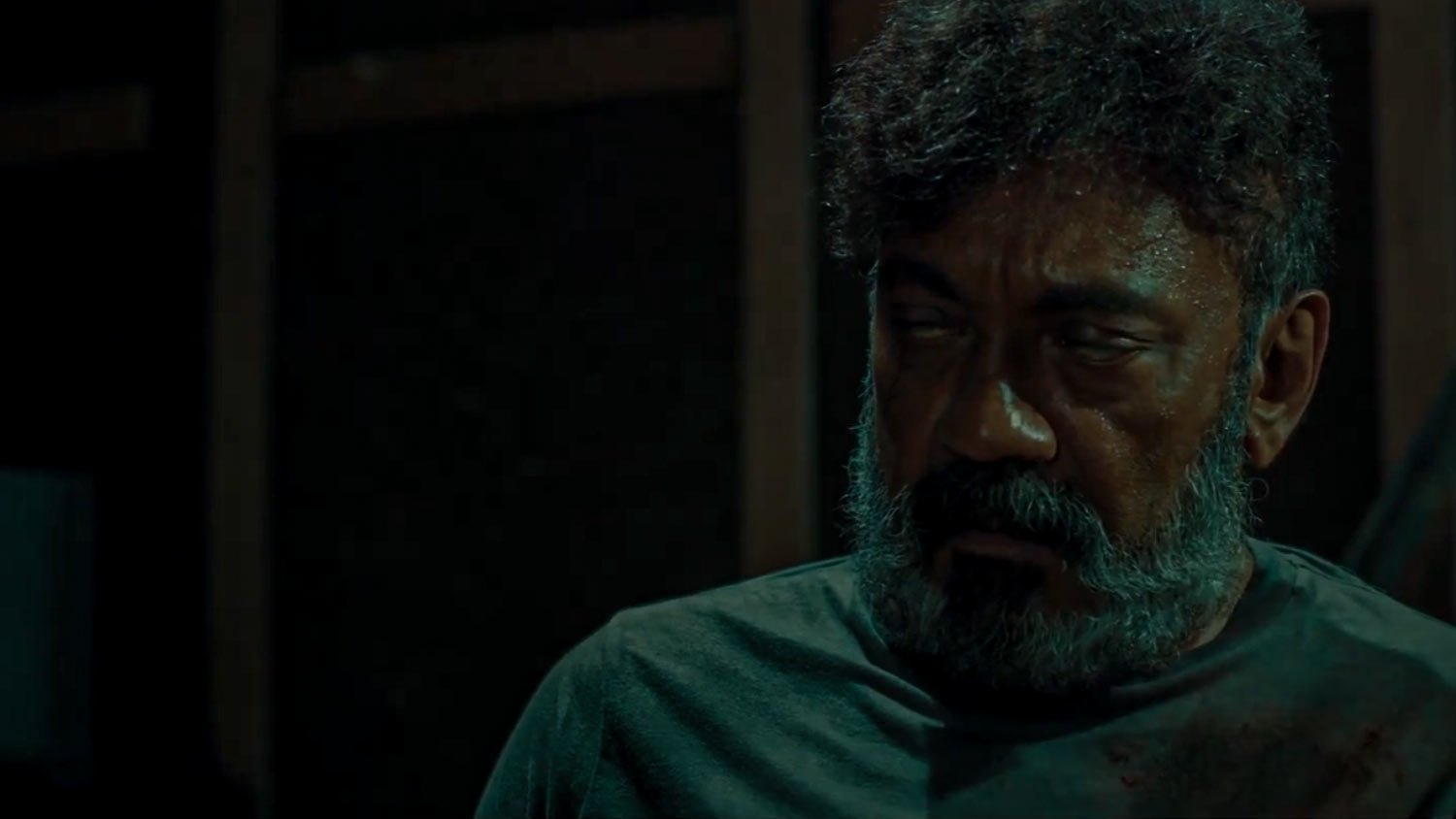 Backdrop for Attention