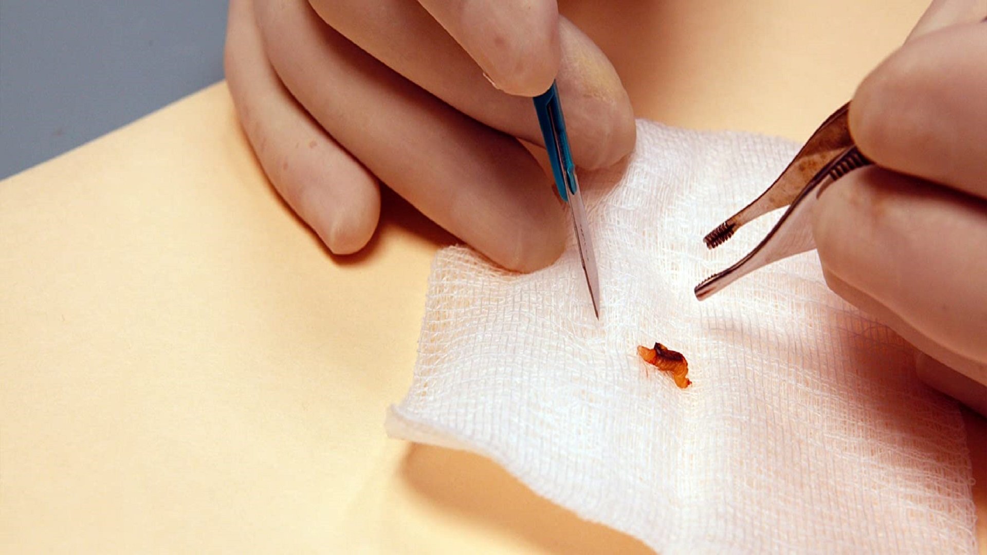 Backdrop for Patient Seventeen