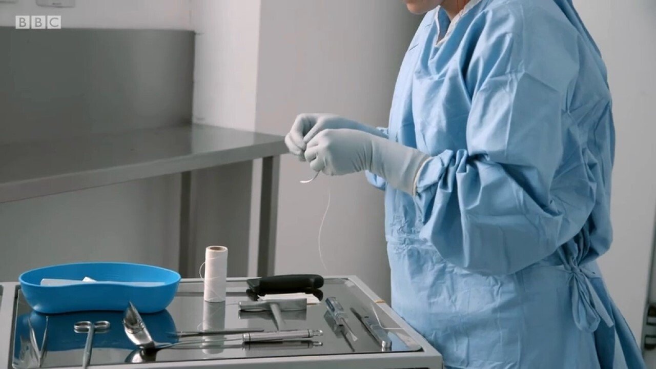 Backdrop for Obesity: The Post Mortem